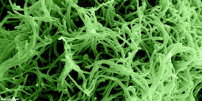 Что реально нужно сделать для борьбы с вирусом Эбола
